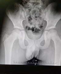 ����11���к��������˸�6���׵�...