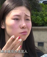 一针下去,浙江姑娘嘴巴歪斜,更惨的是……