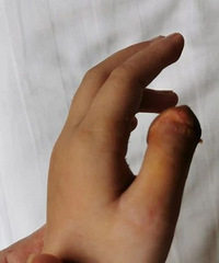 һ��紵�����㽭5��Ů������ָ���ˣ������������˵�ͯ����Ӱ��