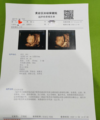 ���ڵȵ���+�������ռǣ�