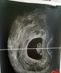 ���겻�У���ҩ��֪�����˶��٣��Թ�һ�γɹ�