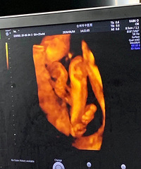 ���⾪ϲ֮Сħ���ĵ����������ռǡ�