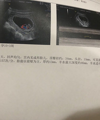 2020�������һ���¡����������û+�������ռǡ�