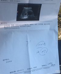 ��ʱ����+�������ռǡ�