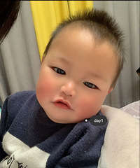 ��״������Ⱦ��ҽ��˵һ�����������͵�7��ʱ��