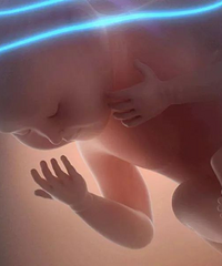 ��̥�ļ໤��������ϵı��������а취