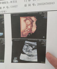 �������ռǡ�һ�����ۣ��ӻ��е�����ס������Ժ��