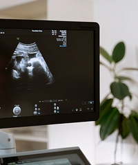 ���Ż��ܲ�����е�̥�������𣿷���һ��ͨ�����Ż��ľ���