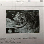 nt�󱦰�ֱ��̫����