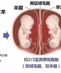 Ϊʲô�е�˫��̥�����еĲ��ܴ󣿿���3��ͼ��������