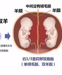 Ϊʲô�е�˫��̥�����еĲ��ܴ󣿿���3��ͼ��������