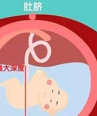 ��ˮ�ˣ�����ΪʲôҪƽ�ɣ������ȥҽԺ���