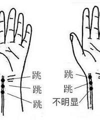 ��ҽ�����ġ�ϲ����������Բ�һ���ܲ�����