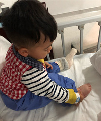 2周不到因为小肠气上了手术台,报销了也不贵大概3200左右
