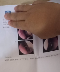 [��ô��]������������뱣�����ƣ�ҽ��˵һ�ܷ�����Ѫ