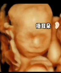 ��˵�ְ����賳�ܵ�ʱ�򣬶����ﱦ���ķ�Ӧ�������ġ���