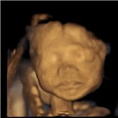 ��ά�����޺ü���