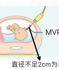 ��ˮ�ٵ�ԭ������Щ����ô��ϣ��и���ô���ܳ���ˮ��