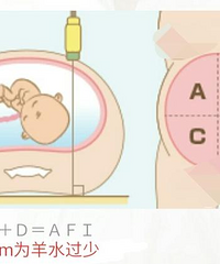 ��ˮ�ٵ�ԭ������Щ����ô��ϣ��и���ô���ܳ���ˮ��