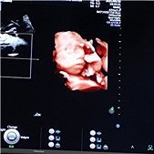 ��άԼ����ϼ��������