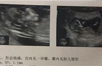 ����ҽ��������̥�Ļ��ɺ��������⣬�һ���