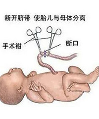 ������������Ϣ�ж�ɱ̥������������ź���Ҫ��