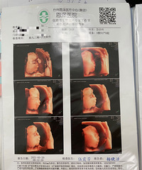 лл��ѡ���ǵ���İְ�����+��2021�����ռǡ�