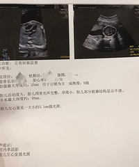 [����]��ְ��̥��̥������ǿ�������һ���޴�+̥������