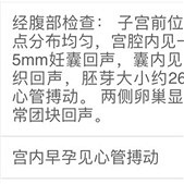 �ս���鱦��������