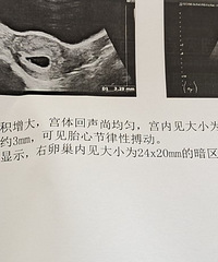 ͻȻ�ͻ����ˡ�2022�����ռǡ�