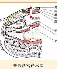 ͬ���ǰ�һ����˳�����к��ʸ��������ж��