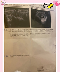 ���ڷ��ó��̵㡾2022�����ռǡ�