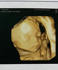 ���籦��������+��2022�����ռǡ�