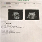 �õ�������������֮��