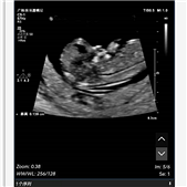 Ԥ����7��20�յı���