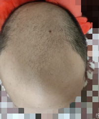 ������27���ͺ����