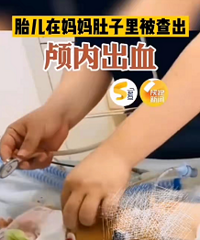 ���գ�̥�������踹���Գ�Ѫ��50����