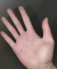 ���������׸�¥���ҽ������ͷ���ϣ�����������