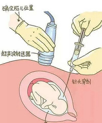 1500���������������飺�޴������򴩣�����������ô���Ű�ȫ