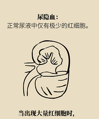 ʮ������Ÿ��²ۡ�Ϊɶÿ�β��춼Ҫ���򣿡���׼������