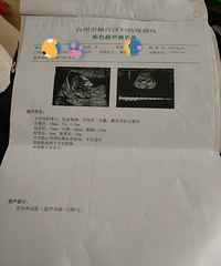 [����]����ʱ�ް���ˮ��������޸�ͷ̫��������ʹ��