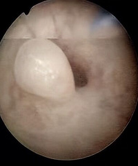 �����˸��ַ�����Ȼ�޷����У��п�������������ĸ��Ʋ�������