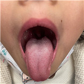 ��Ƣθ������ô��