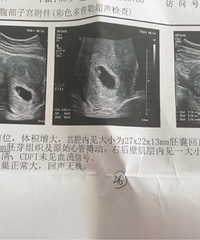 ���յ����ռǣ������ռǣ�