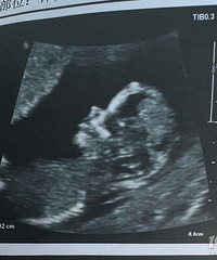 �ҵİ��ϻ��ͣ������ռǣ�