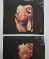 �����������µ���ҩ�������˶�˵��ҩ���Ե����������������