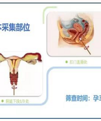 ������������Ⱦ���գ��������ڼ�鲻�ɺ���