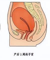 ���� | ������һ�����ӡ������ӹ����Ļָ�