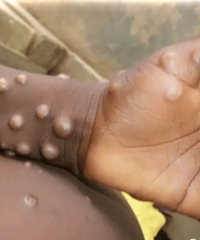 ���ﶻ�������������ڣ��������ͯ��в��󣬱��¹ڻ����£�