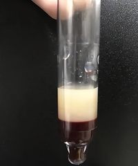 �и���Σ��סICU��������׾�������ļ�Ѽ����